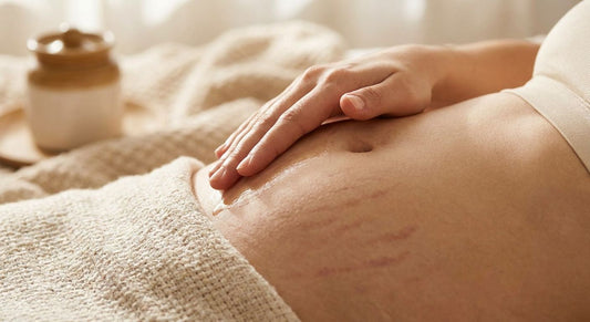 How to fade discolored stretch marks