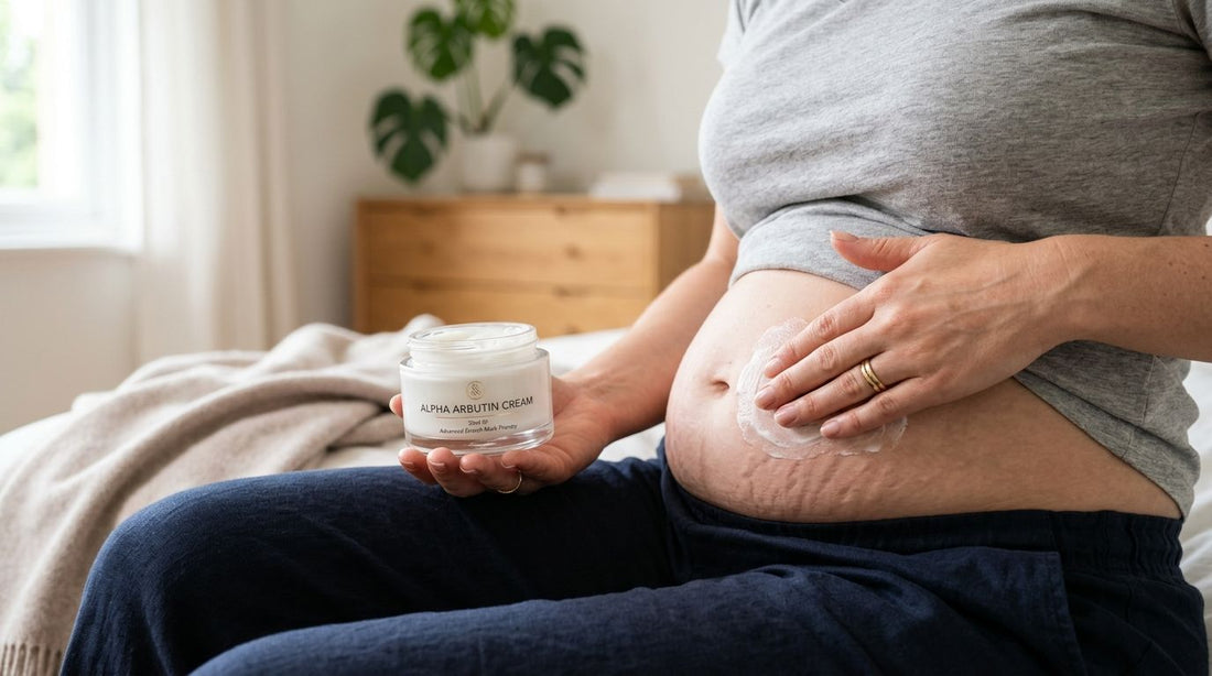 Alpha arbutin cream for stretch marks