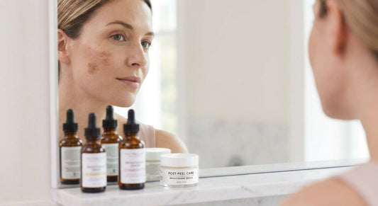 How to fade dark spots after a chemical peel