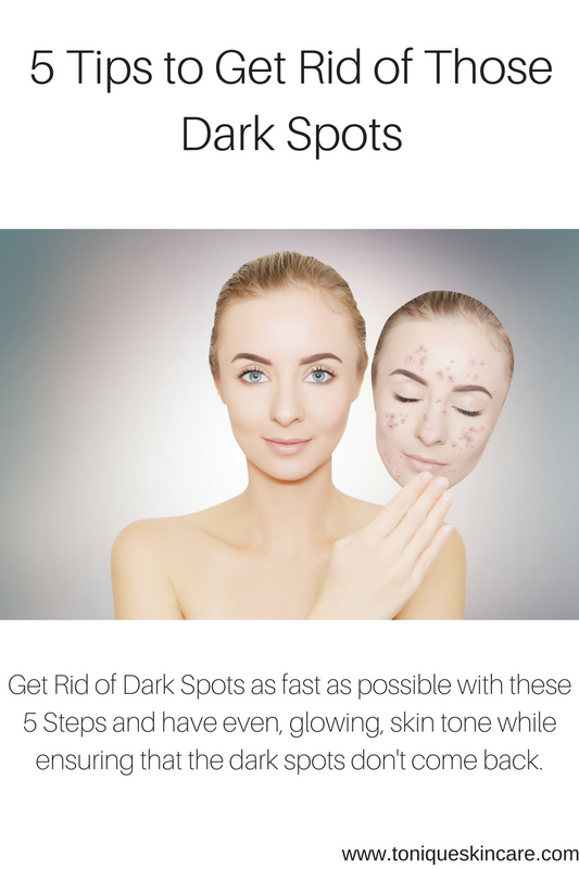 5 Tips to Get Rid of Dark Spots
