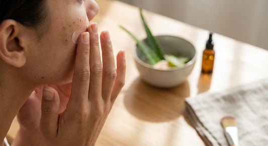How to fade dark spots from over-exfoliation
