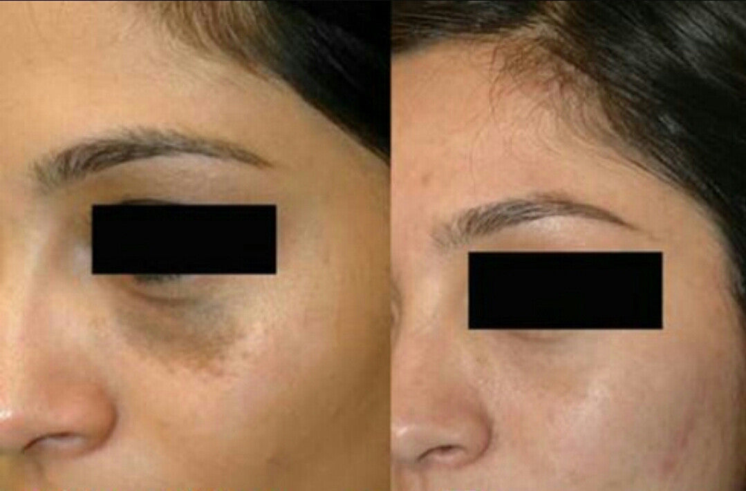 The Benefits Of Lightening Your Skin Or Skin Lightening Products