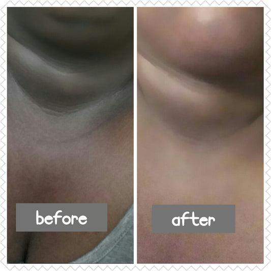 Skin Lightening Photos
