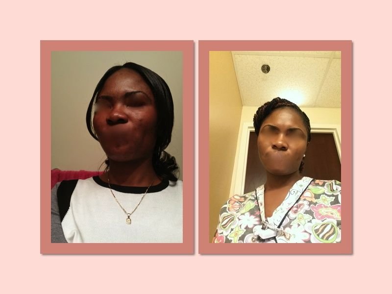 Tonique customer before and after