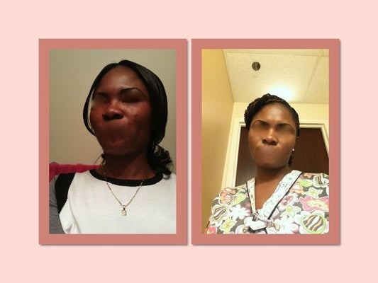Tonique customer before and after