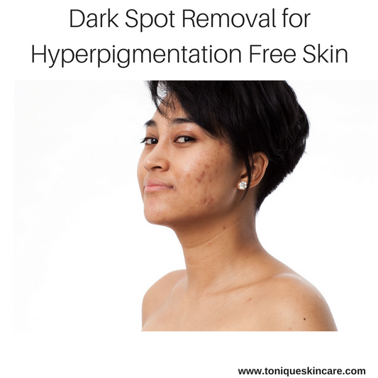 Dark Spot Removal for Hyperpigmentation Free Skin