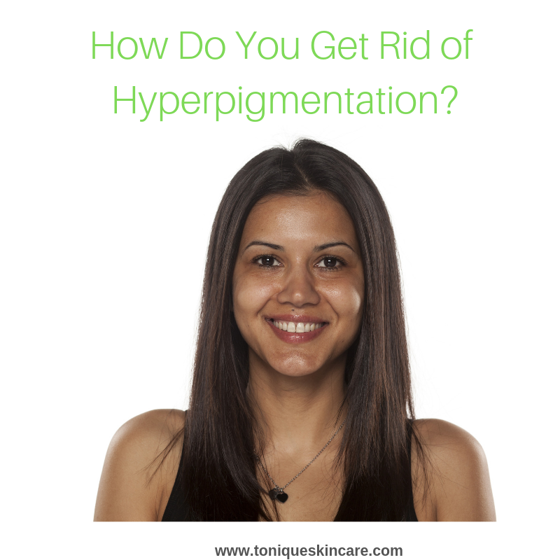How Do You Get Rid of Hyperpigmentation? Tonique Skincare