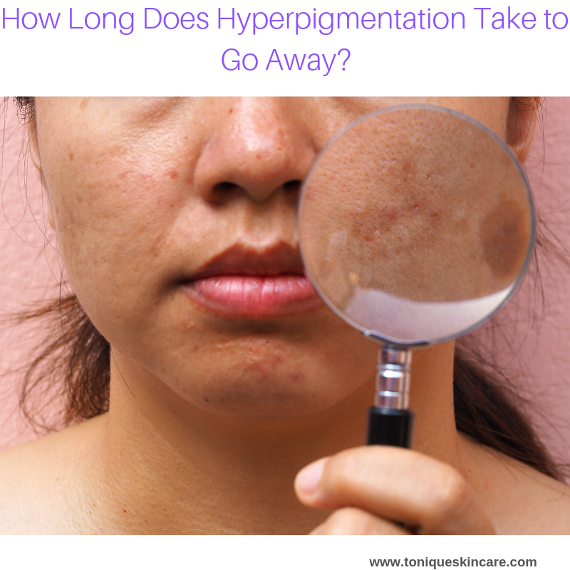 How Long Does Hyperpigmentation Take to Go Away?