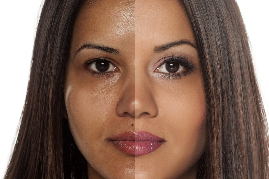 How To Even Tone Blotchy Skin