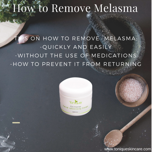 How to Remove Melasma