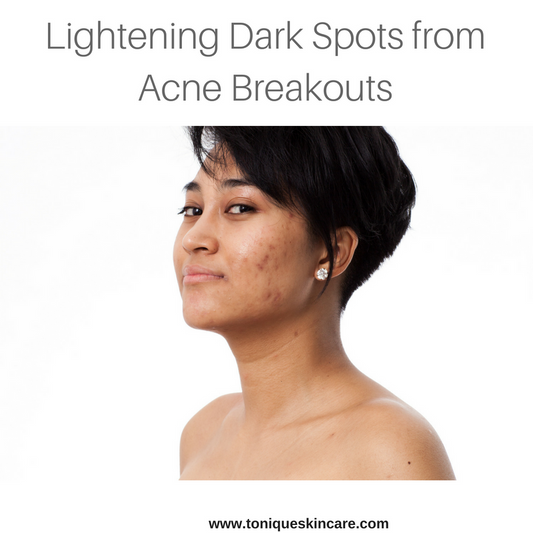 lightening dark spots article image