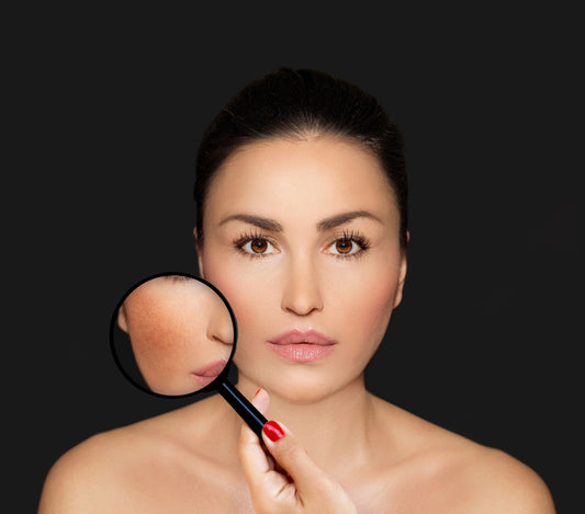 Why You Should Use Skin Lightening Creams For Dark Marks