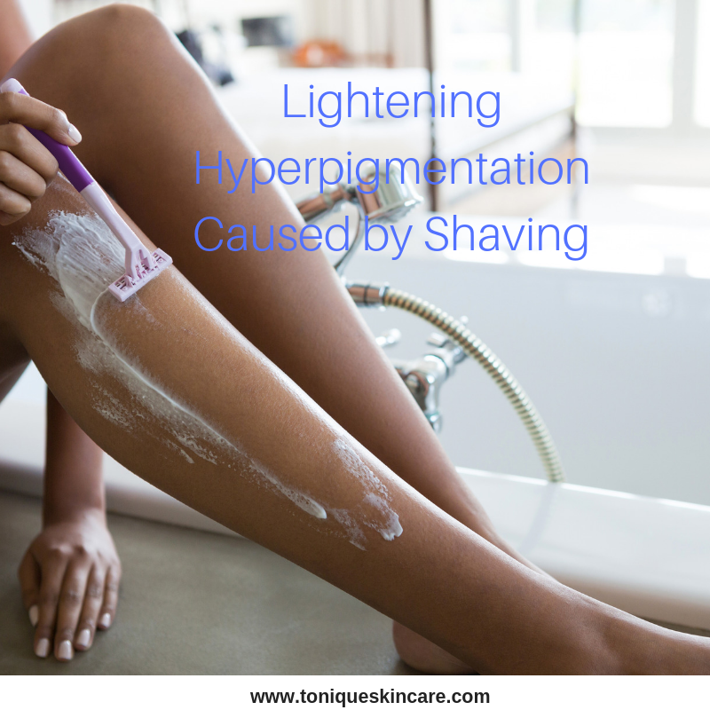 lightening hyperpigmentation caused by shaving article picture