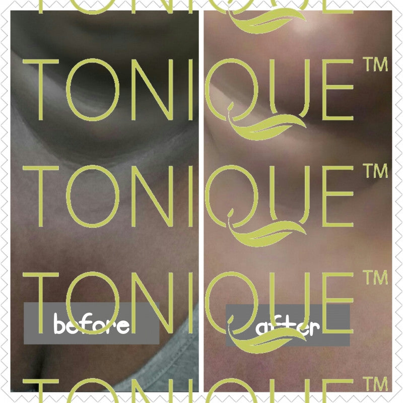 Natural Skin Whitening
