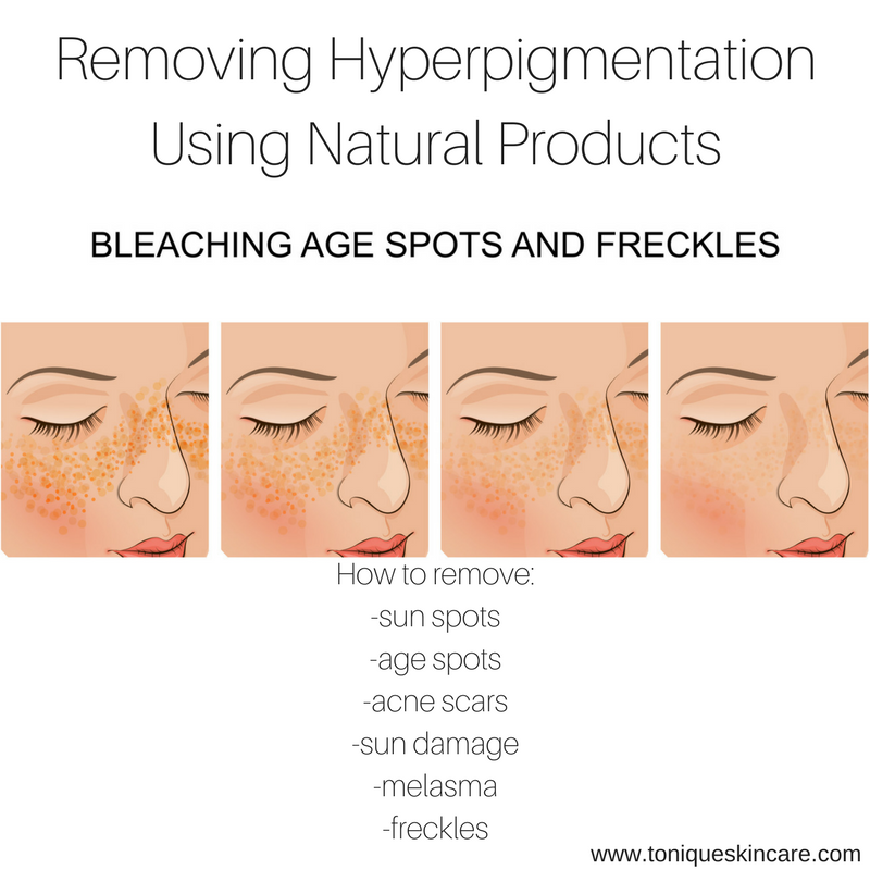 hyper pigmentation removal picture