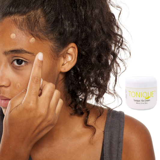 removing dark spots from the skin