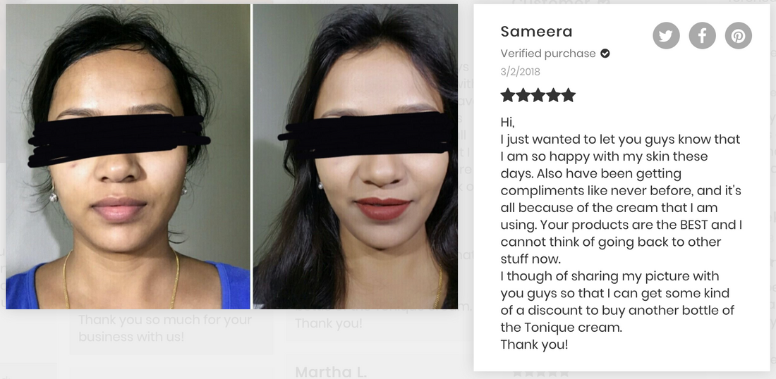 the best skin lightening cream pic