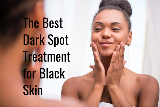 The Best Dark Spot Treatment for Black Skin
