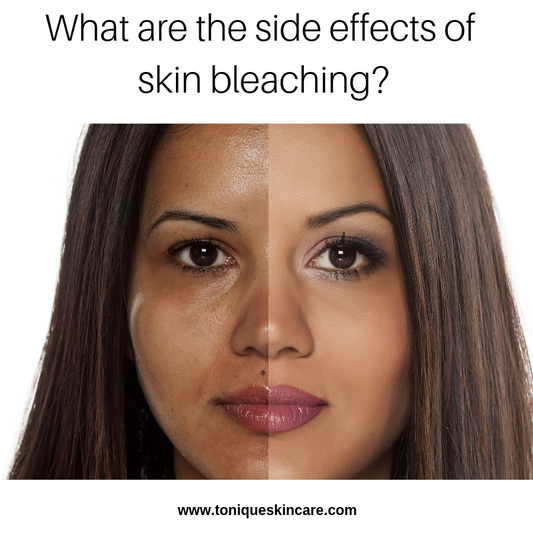 the side effects of skin bleaching article pic