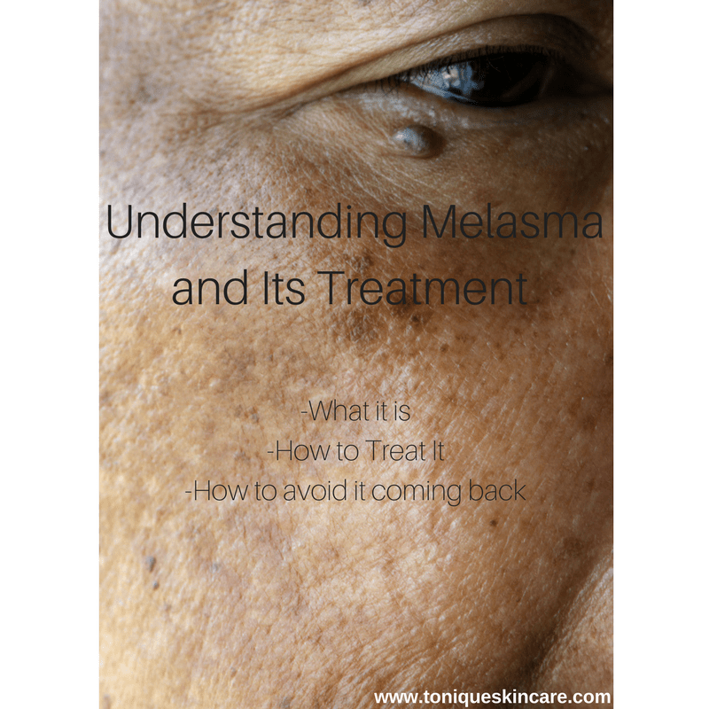 Understanding Melasma and Its Treatment