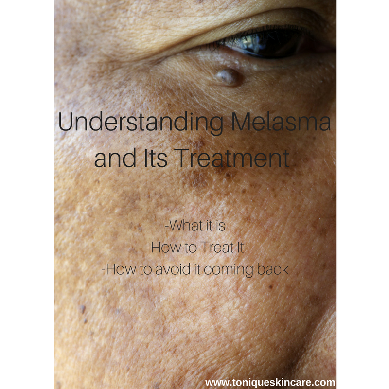 Understanding Melasma and Its Treatment