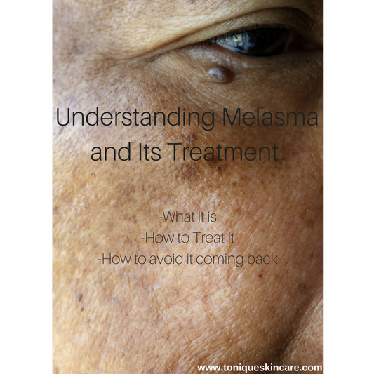 Understanding Melasma and Its Treatment