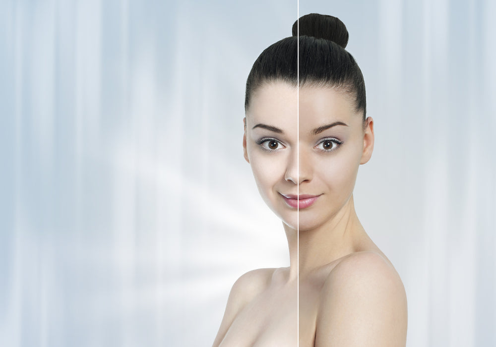 skin bleaching cream