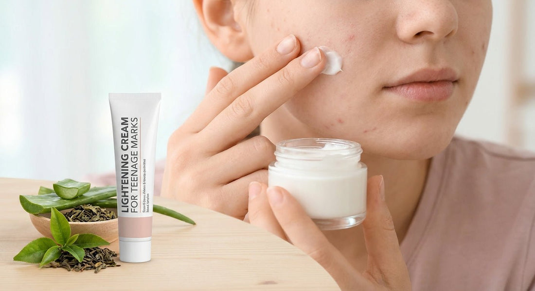 Best skin lightening cream for teenage acne marks