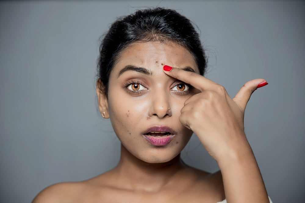 woman with dark spots