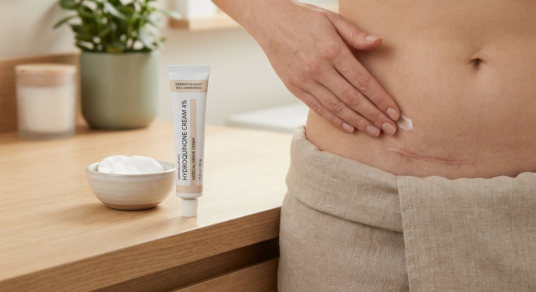 Hydroquinone cream for c-section scar discoloration