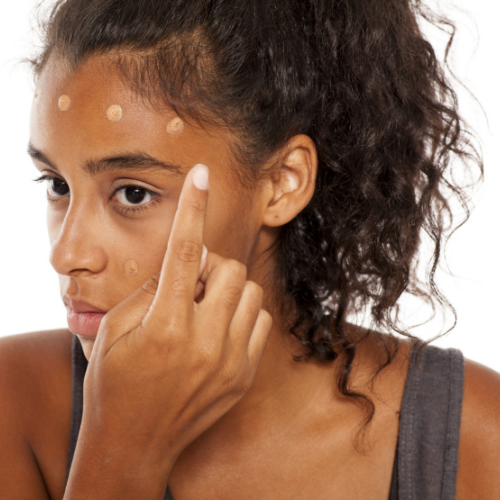 The Fastest and Easiest Way to Treat Dark Spots