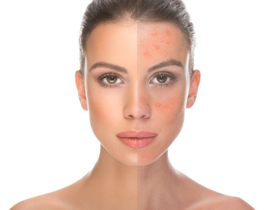 Skin Whitening Company