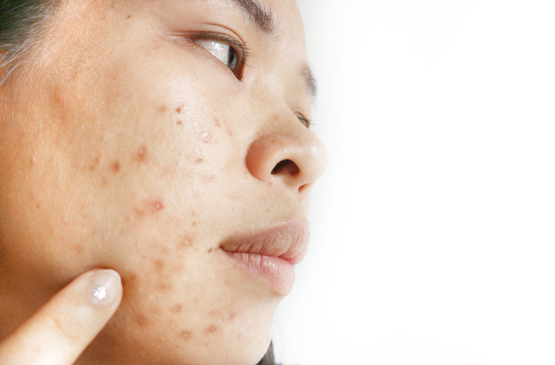 woman with dark spots